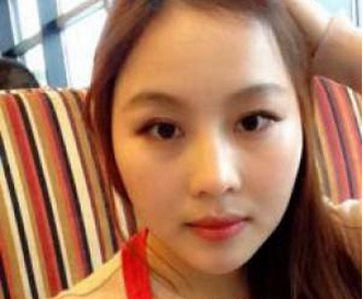 自体脂肪丰额头  提升面部美丽一百分 - 珍美网