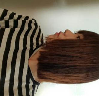 玻尿酸面部填充  快速告别苍老的现象实现活力美的自己 - 珍美网