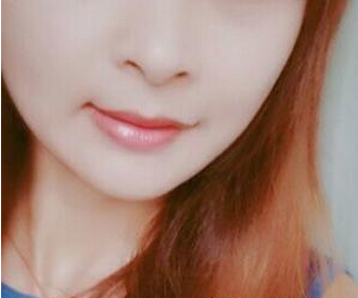 苏州工业园区瑞芙臣医疗美容诊所徐增亮医生瘦脸案例：变小v脸很 - 珍美网