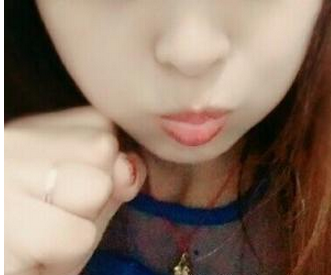 苏州工业园区瑞芙臣医疗美容诊所徐增亮医生瘦脸案例：变小v脸很