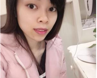 玻尿酸隆下巴 脸部变得柔和让我更加美丽 - 珍美网