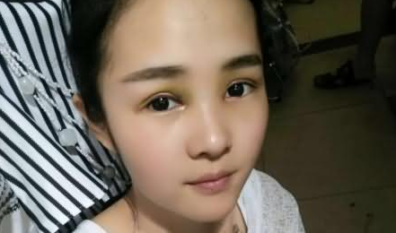 双眼皮手术  让我更加美丽迷人 - 珍美网