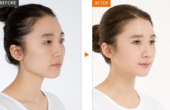 巴掌脸的秘密？？？