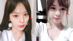 上海九院削骨韦敏和靳小雷那个好？