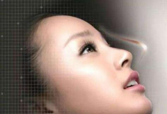 鼻头鼻翼缩小术助你即刻拥有精致俏鼻