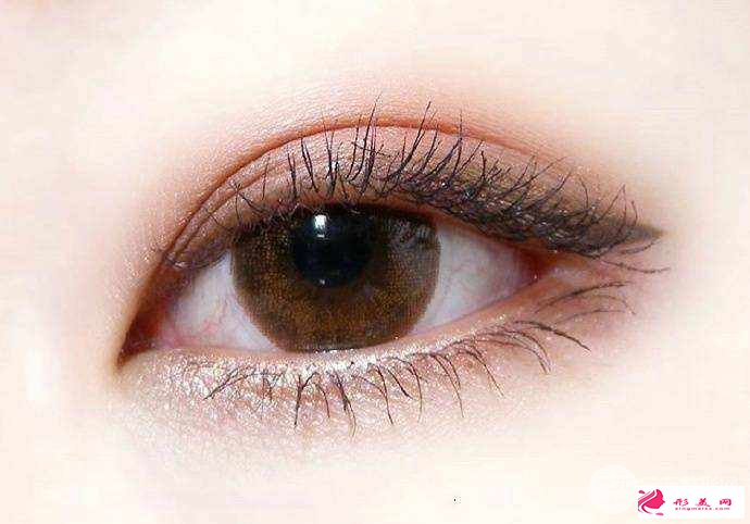 双眼皮埋线后多久自然?