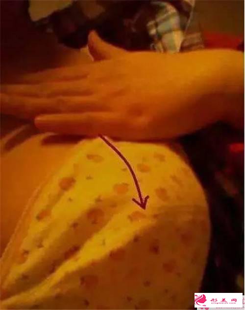 乳晕缩小手术后遗症_乳晕缩小手术后会留疤吗?