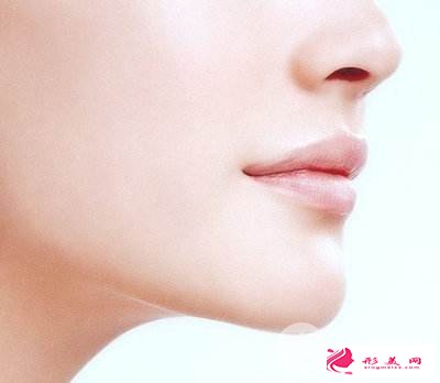 垫下巴后应该怎么护理,多久能消肿?