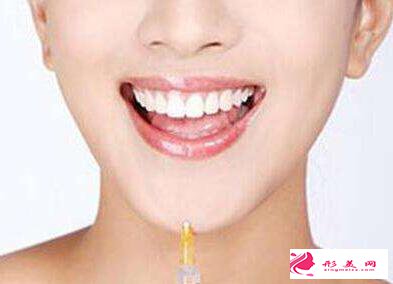 玻尿酸丰下巴被吸收了可以补打吗