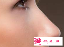 假体隆鼻会不会有感染的问题