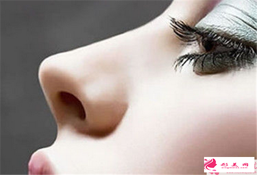 2大热门假体隆鼻整形效果_假体隆鼻术用何种原料更稳固