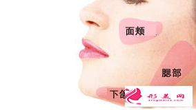 自体脂肪填充脸部后可以减肥吗