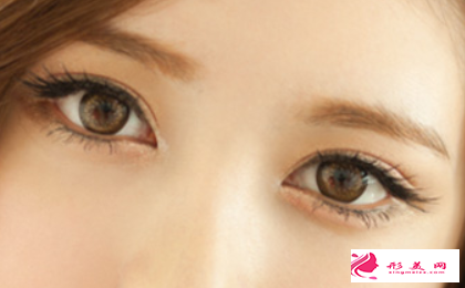 割双眼皮出血大吗