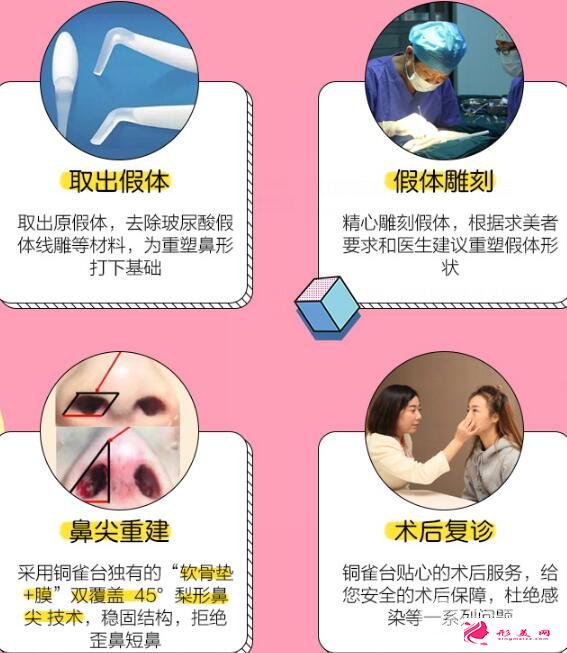 隆鼻失败怎么办?鼻修复手术过程