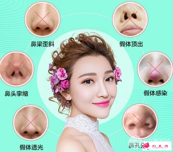 隆鼻失败怎么办?鼻修复手术是怎么做的?