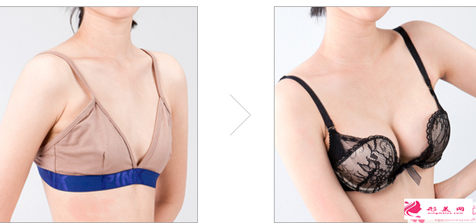 假体隆胸手术前后分别需要准备的事情