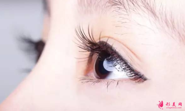 割双眼皮要做什么准备吗