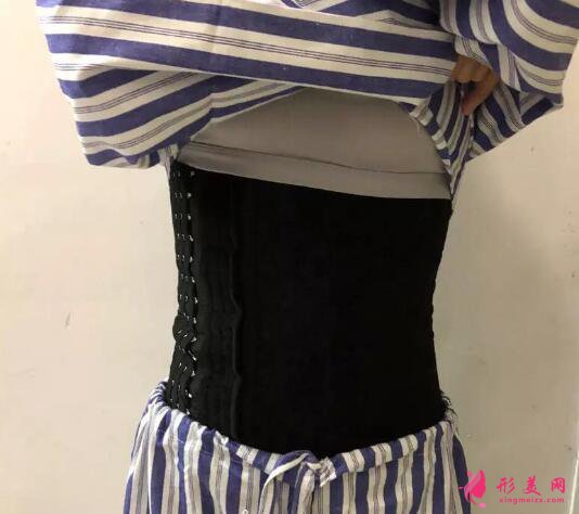 360吸脂案例对比,成功瘦身成为大美女啦!