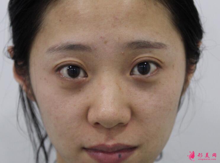 想知道黑脸娃娃美白效果?看看这个案例体验吧