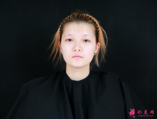 深圳美加美医疗美容怎么样?双眼皮案例你不得不看