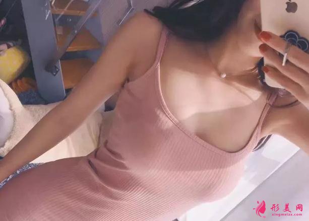 深圳张亚军医生做手臂吸脂手术术后半年