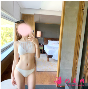 深圳富华斯良洪做腰腹部吸脂怎么样?90天效果对比真的很棒