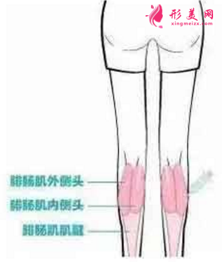 注射瘦腿针1个月,谈谈效果