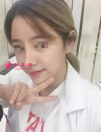 鼻子做假体已经5个月了