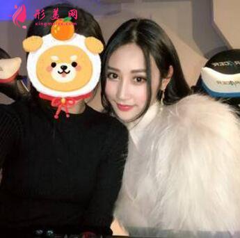 感受田永成双眼皮技术的精细效果怎么样,真实案例照片