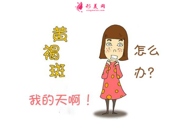 如何去黄褐斑比较有效?