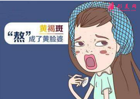 如何去黄褐斑比较有效?