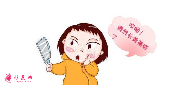 如何去黄褐斑比较有效?