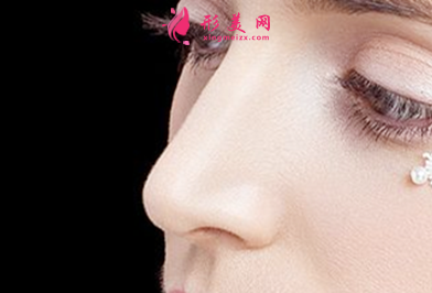 假体隆鼻拆线后留疤吗