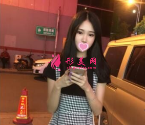 武汉同济整形王海平隆鼻怎么样？前后60天对比图 案例分享