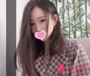 武汉同济整形王海平隆鼻怎么样？前后60天对比图 案例分享