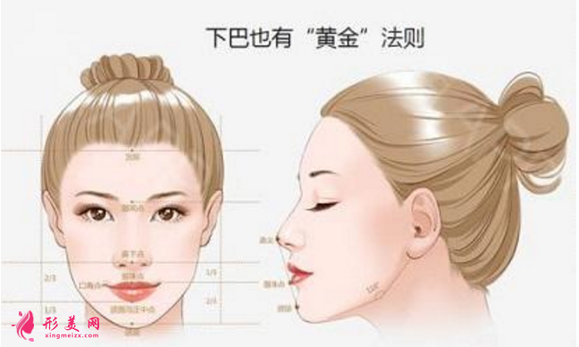 都说膨体容易感染,膨体垫下巴到底值不值得做?