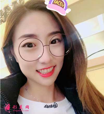 和颜美帕刘喆做白瓷娃娃怎么样?术后60天真人案例效果分享~