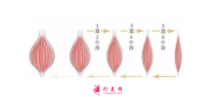 打瘦脸针大概多少钱?瘦脸的原理是什么?