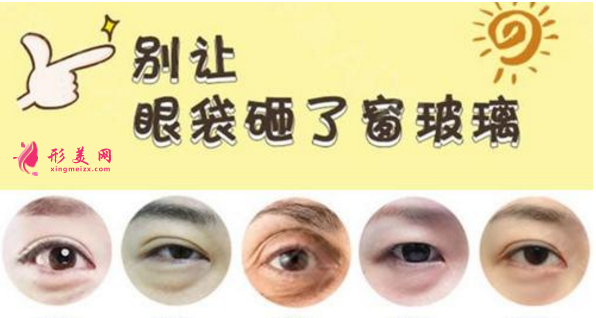 做去眼袋手术多少钱?有哪些方法?