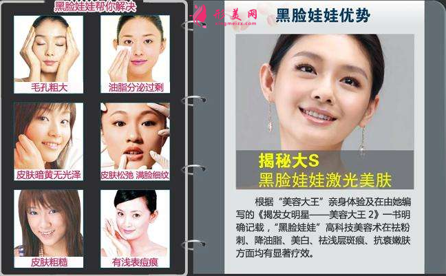 什么是黑脸娃娃?原理和作用可以了解下~
