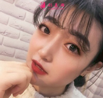 北京画美瘦脸案例
