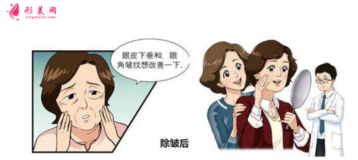 注射除皱效果怎么样?附术前术后注意事项!