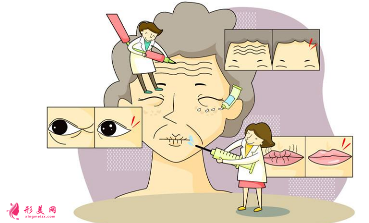 注射除皱效果怎么样?附术前术后注意事项!