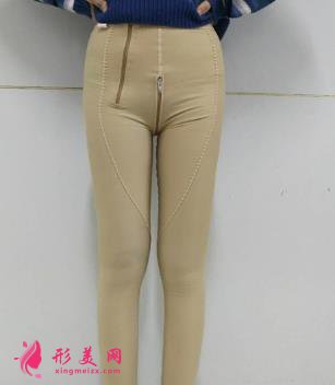 郑大二附院整形科刘月丽抽脂怎么样?大腿抽脂案例来查看!