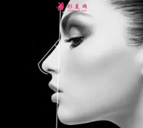 隆鼻和鼻综合有什么不同?选择哪一种手术方式更好?
