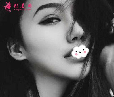 整形初体验:假体隆鼻后整理的隆鼻经验分享给大家【附图】