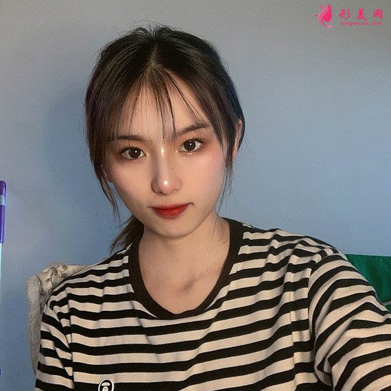 开内眼角 开内眼角