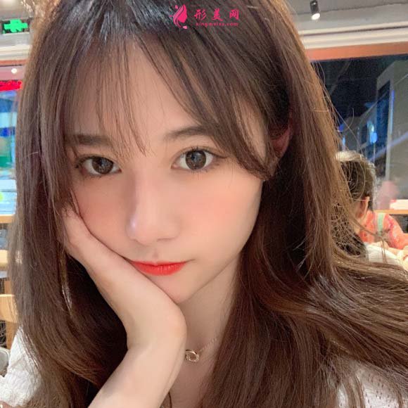 面部脂肪填充手术真实恢复过程,记录美好生活 面部脂肪填充手术真实恢复过程,记录美好生活