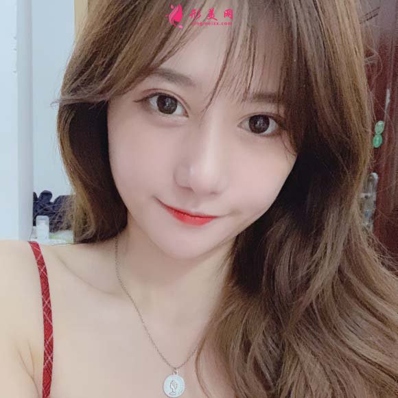 面部脂肪填充手术真实恢复过程,记录美好生活 面部脂肪填充手术真实恢复过程,记录美好生活