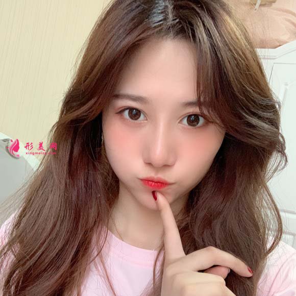 面部脂肪填充手术真实恢复过程,记录美好生活 面部脂肪填充手术真实恢复过程,记录美好生活